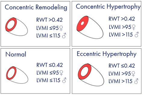 left ventricular mass index calculator